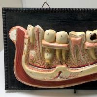 German Dental Display of Jaw Bone and Teeth Plaster New York Biologiocal Supply 1.jpg